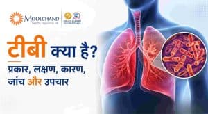 टीबी (Tuberculosis) क्या है टीबी के लक्षण, कारण और उपचार