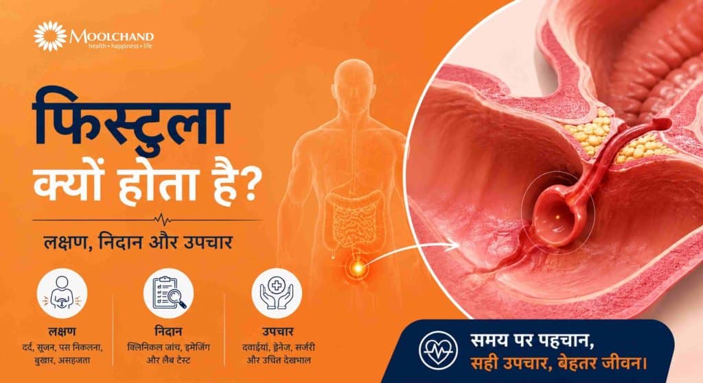 फिस्टुला क्यों होता है? लक्षण, निदान और उपचार