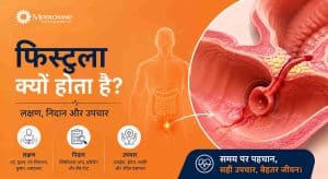 फिस्टुला क्यों होता है? लक्षण, निदान और उपचार