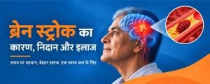ब्रेन स्ट्रोक: कारण, लक्षण, जाँच और इलाज | मूलचंद